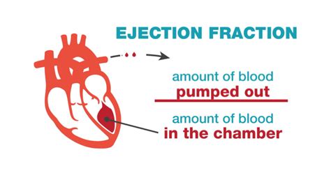 how to explain ejection fraction.